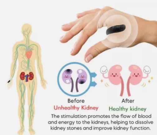 Sugar Control LI4 Acupressure Point Clip (Original)